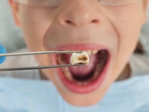 Best Orthodontic Emergency Dentist in Pine Beach, NJ