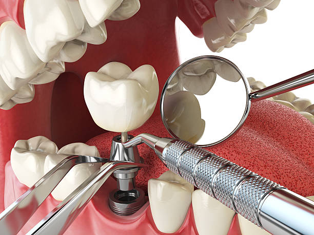 Best Emergency Root Canal Treatment in Pine Beach, NJ
